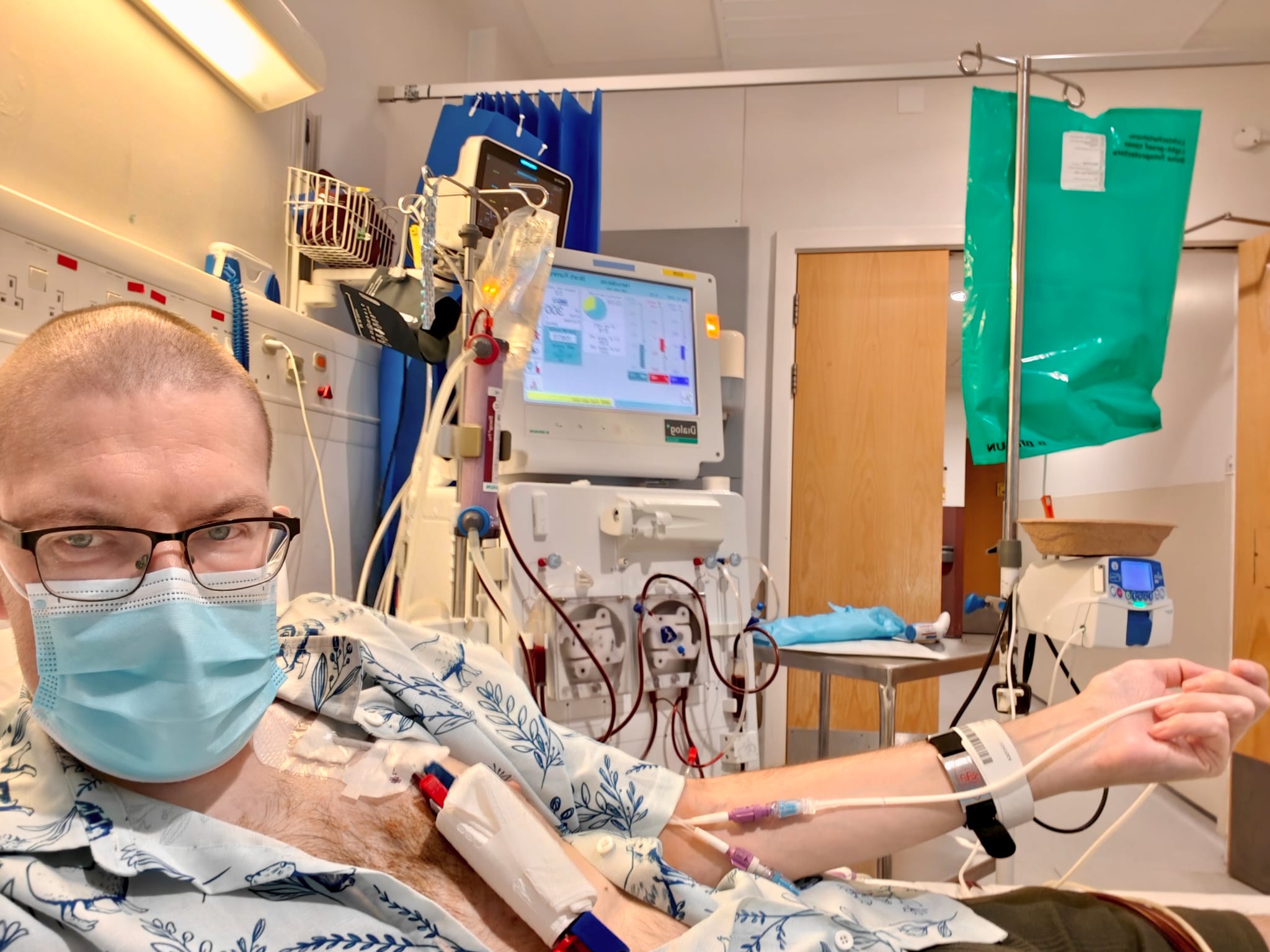 Martin Paul Eve in hospital, on a dialysis machine and an IV feed drip, with a PICC line in his arm and a central line in his chest